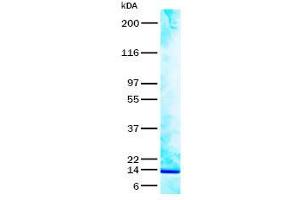 Validation with Western Blot (RSPO2 Protein)