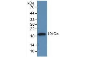 Detection of Recombinant IL18BP, Human using Monoclonal Antibody to Interleukin 18 Binding Protein (IL18BP) (IL18BP antibody  (AA 31-194))