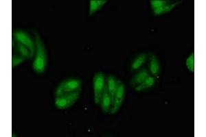Immunofluorescent analysis of HepG2 cells using ABIN7159726 at dilution of 1:100 and Alexa Fluor 488-congugated AffiniPure Goat Anti-Rabbit IgG(H+L) (MGST2 antibody  (AA 27-57))