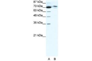 C14ORF101 antibody used at 5 ug/ml to detect target protein. (C14orf101 antibody  (N-Term))