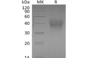 Western Blotting (WB) image for Hepatitis A Virus Cellular Receptor 2 (TIM 3) (AA 20-191) protein (His tag) (ABIN7320773) (TIM3 Protein (AA 20-191) (His tag))