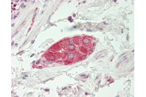 Human Colon, Submucosal Plexus: Formalin-Fixed, Paraffin-Embedded (FFPE). (BCKDK antibody  (AA 111-160))