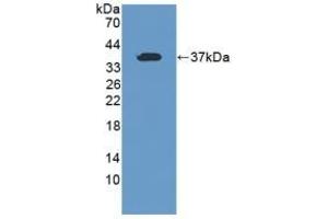 Detection of Recombinant TFR2, Human using Polyclonal Antibody to Transferrin Receptor 2 (TFR2) (Transferrin Receptor 2 antibody  (AA 493-784))