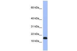 Image no. 1 for anti-Ribosomal Protein L37a (RPL37A) (C-Term) antibody (ABIN6741657) (RPL37A antibody  (C-Term))