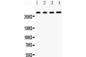 Anti- IP3 receptor antibody, Western blotting All lanes: Anti IP3 receptor  at 0. (ITPR1 antibody  (AA 2411-2758))