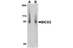 Western blot analysis of BICD2 in A549 cell lysate with AP30146PU-N BICD2 antibody at (A) 1 and (B) 2 μg/ml.