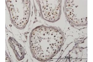 Immunoperoxidase of monoclonal antibody to IRF5 on formalin-fixed paraffin-embedded human testis. (IRF5 antibody  (AA 395-504))