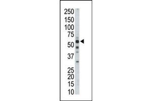 The anti-PKLR Pab is used in Western blot to detect PKLR in mouse liver tissue lysate. (PKLR antibody  (C-Term))