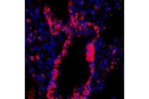 Immunofluorescent analysis of paraformaldehyde-fixed rat lung using,CD63 (ABIN7073400) at dilution of 1: 1500 (CD63 antibody)