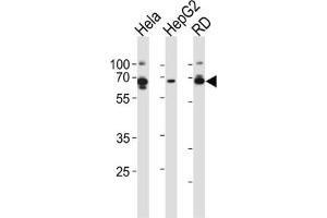 Western Blotting (WB) image for anti-Protein Kinase, AMP-Activated, gamma 3 Non-Catalytic Subunit (PRKAG3) antibody (ABIN2999063) (PRKAG3 antibody)