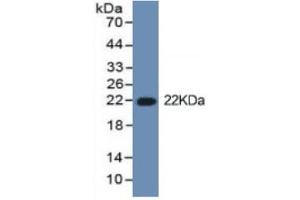 Western Blotting (WB) image for Interleukin 1, beta (IL1B) ELISA Kit (ABIN6574166)