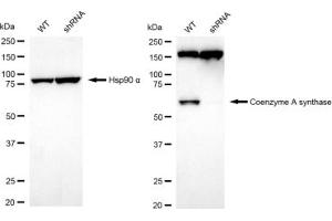 anti-CoA Synthase (COASY) antibody