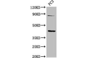Western Blot Positive WB detected in: PC-3 whole cell lysate All lanes: TNFRSF19 antibody at 2. (TNFRSF19 antibody  (AA 276-415))