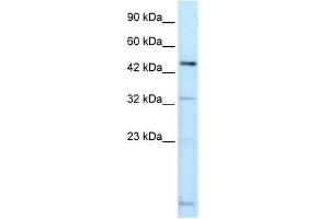 DMRTA2 antibody used at 0. (DMRTA2 antibody  (C-Term))