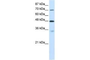 Western Blotting (WB) image for anti-Cysteinyl-tRNA Synthetase (CARS) antibody (ABIN2462085) (CARS antibody)