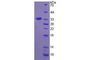 Image no. 1 for Tryptase beta 2 (TPSB2) (AA 30-274) protein (His tag) (ABIN4990021)