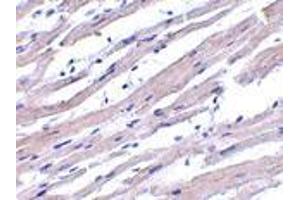 Immunohistochemistry of Apaf1 in human heart tissue with Apaf1 antibody at 1 μg/ml. (APAF1 antibody  (N-Term))