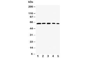 Western blot testing of RelB antibody and Lane 1:  rat testis (RELB antibody  (AA 393-413))