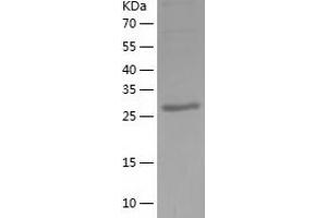 Western Blotting (WB) image for Zinc Finger Protein 418 (ZNF418) (AA 124-416) protein (His tag) (ABIN7288044) (ZNF418 Protein (AA 124-416) (His tag))