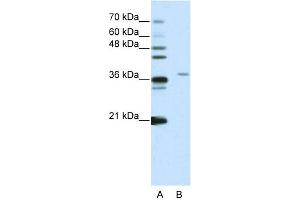 WB Suggested Anti-SART3 Antibody Titration:  2. (SART3 antibody  (N-Term))