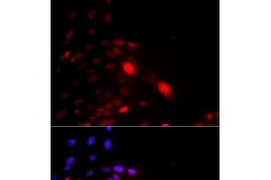 Immunofluorescence analysis of U2OS cells using DDB2 Polyclonal Antibody (DDB2 antibody)
