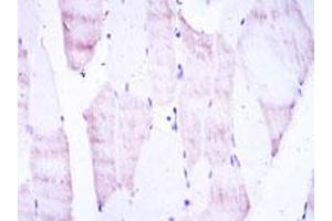 Immunohistochemical analysis of paraffin-embedded human muscle tissue using OLIG2 monoclonal antobody, clone 1G11  with DAB staining.