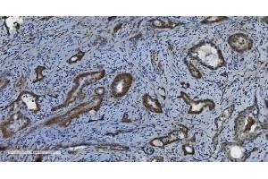 IHC analysis of PARP using anti-PARP antibody (ABIN7602277).