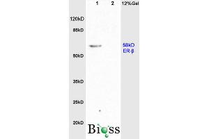 L1 rat brain, L2 rat colon lysates probed (ABIN725855) at 1:200 in 4 °C. (Estrogen Receptor alpha + beta (AA 201-300) antibody)