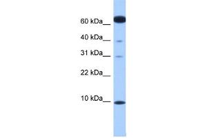 WB Suggested Anti-DYNLL2 Antibody Titration: 0. (DYNLL2 antibody  (N-Term))