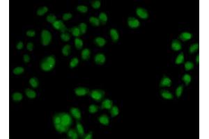 Immunofluorescence analysis of HeLa cells using OAS1 antibody (ABIN5971361). (OAS1 antibody)