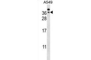Western Blotting (WB) image for anti-General Transcription Factor IIE, Polypeptide 2 (GTF2E2) antibody (ABIN2997737)