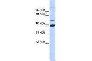 Image no. 1 for anti-Zinc Finger Protein 124 (ZNF124) (AA 179-228) antibody (ABIN6742594)