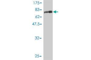 Western Blotting (WB) image for anti-serine/threonine Kinase 38 (STK38) (AA 1-465) antibody (ABIN7199720)