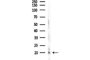 Western blot analysis of lysates from K562 cells(heat-shock,45 min treatment), using HES3 Antibody at 1/1000 dilution.