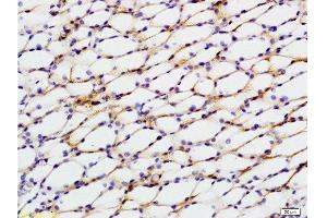 Immunohistochemistry (Paraffin-embedded Sections) (IHC (p)) image for anti-Signal Transducer and Activator of Transcription 2, 113kDa (STAT2) (AA 151-250) antibody (ABIN738246)