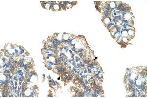 Human Intestine (PARP6 antibody  (C-Term))
