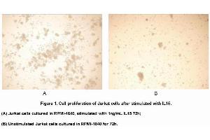 IL-15 Protein (AA 50-162) (His tag)