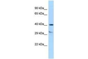 Image no. 1 for anti-Tocopherol (Alpha) Transfer Protein (TTPA) (AA 204-253) antibody (ABIN6747970) (TTPA antibody  (AA 204-253))