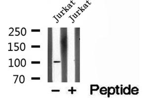 Western blot analysis of extracts of Jurkat cells, using OTUD7B antibody. (OTUD7B antibody  (C-Term))