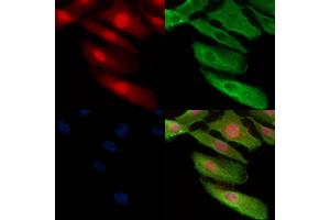 Phospho-TMS1/ASC (Ser195) Antibody staining A549 cells(H2O2 treatment) by IF/ICC.