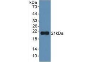Detection of Recombinant IL1a, Human using Monoclonal Antibody to Interleukin 1 Alpha (IL1a) (IL1A antibody  (AA 113-271))