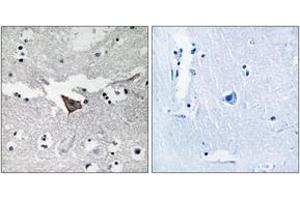 Immunohistochemistry analysis of paraffin-embedded human brain tissue, using FAK (Ab-925) Antibody. (FAK antibody  (AA 892-941))