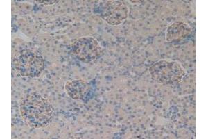 IHC-P analysis of Rat Kidney Tissue, with DAB staining. (PODXL antibody  (AA 153-386))