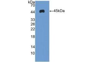 Detection of Recombinant ICAM1, Human using Polyclonal Antibody to Intercellular Adhesion Molecule 1 (ICAM1) (ICAM1 antibody  (AA 41-464))