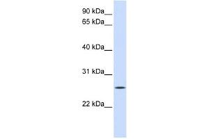 UNC50 antibody used at 1 ug/ml to detect target protein. (UNC50 antibody)