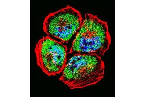 Confocal iunofluorescent analysis of P3 Antibody (N-term)  with NCI- cell followed by Alexa Fluor 488-conjugated goat anti-rabbit lgG (green). (MMP3 antibody  (N-Term))