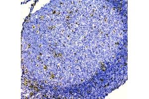 IHC analysis of ZEB2 using anti-ZEB2 antibody (ABIN3042325). (ZEB2 antibody  (AA 1-200))