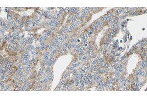 ABIN6276905 at 1/100 staining Human prostate tissue by IHC-P. (IL2RG antibody  (N-Term))