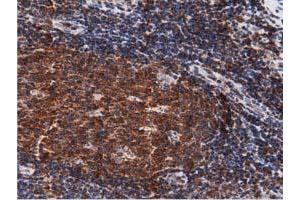 Image no. 7 for anti-DnaJ (Hsp40) Homolog, Subfamily A, Member 2 (DNAJA2) antibody (ABIN1497858) (DNAJA2 antibody)