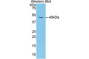 Detection of Recombinant a1AT, Mouse using Polyclonal Antibody to Alpha-1-Antitrypsin (a1AT) (SERPINA1 antibody  (AA 25-413))